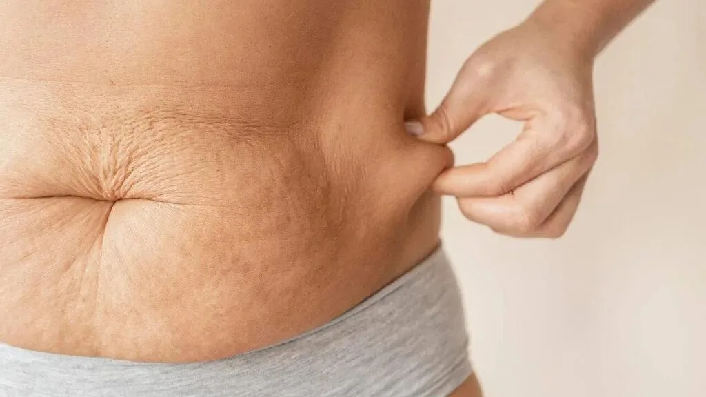 Depois da bariátrica, cirurgia reparadora devolve autoestima, mostra estudo